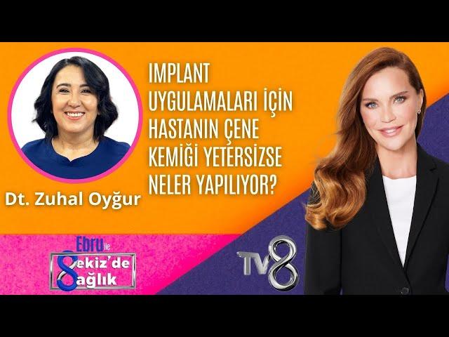 IMPLANT UYGULAMALARINDA ÇENE KEMİĞİ YETERSİZCE NELER YAPILIR? | DT.ZUHAL OYĞUR | 8'de Sağlık