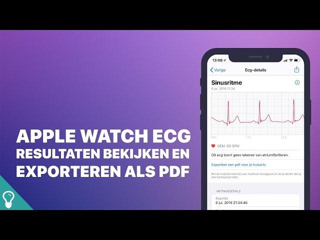 Mini screencast: Apple Watch ECG resultaten bekijken en exporteren als pdf