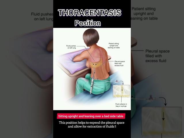 THORACENTASIS POSITION #norcet #norcetaspirants #norcet8 #studyadvice #ytshorts #aiims #medical