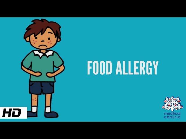 Food Allergy, Causes, Signs and Symptoms, Diagnosis and Treatment.