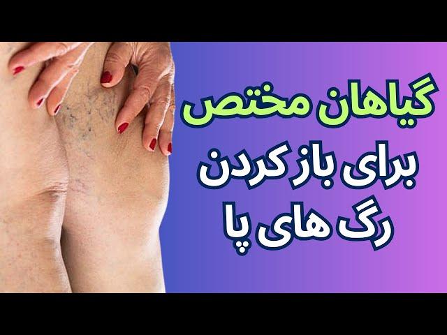 گیاهان خاص مخصوص باز کردن رگ های پا در بدن