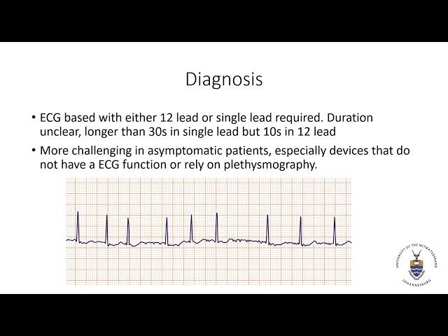 Atrial fibrillation: What’s new in the 2024 ESC guidelines