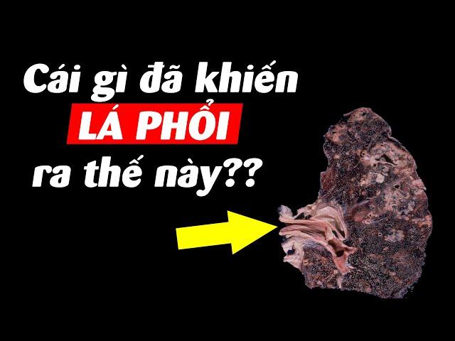 Bụi mịn là gì? Sự đáng sợ kinh khủng của nó