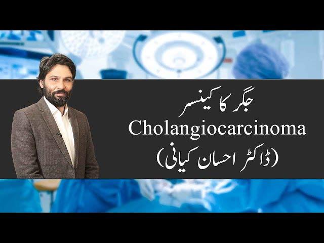 Dr Ahsaan kiani | Cholangiocarcinoma | Bile Duct Cancer | Dr. Faisal Dar's Team