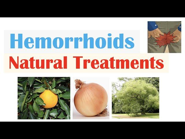 How To Treat Hemorrhoids | 9 Natural Treatments (Plant Flavonoids) for Hemorrhoidal Disease