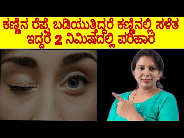 ಕಣ್ಣಿನ ರೆಪ್ಪೆ ಬಡಿತ, ಕಣ್ಣಿನ ನರಗಳಲ್ಲಿ ಸೆಳೆತ |ಕ್ಷಣದಲ್ಲೇ ಗುಣವಾಗಲು ಈಗಲೇ ವೀಡಿಯೋ ನೋಡಿ Twitching Eyes