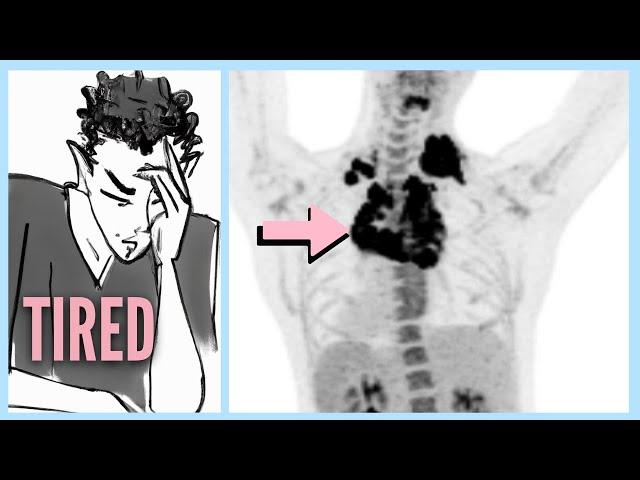 LYMPHOMA After Ignoring 6 WARNING Signs