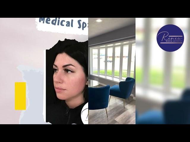 Dermaplaning in Racine by Renew Medical 53404