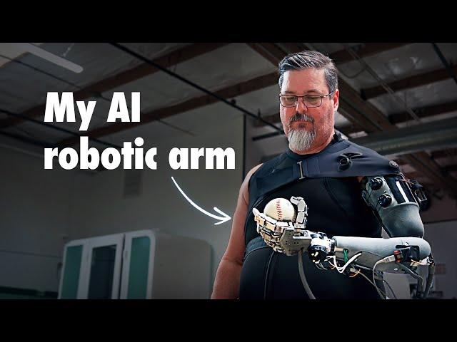 They're Building Him an AI Powered Robotic Arm