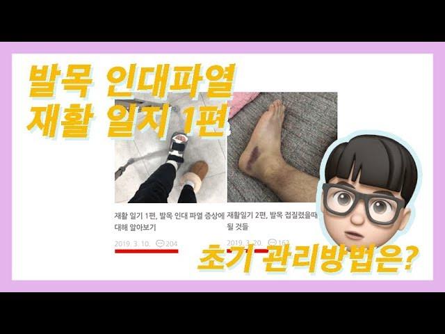 발목 인대파열 재활 과정 1편, 초기 관리방법 알아보기