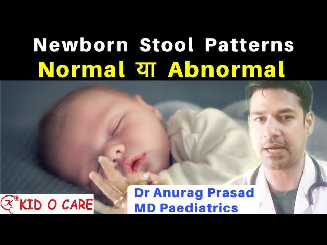 Newborn Stool Problems | Frequency Consistency Colour | Dr Anurag Prasad | vlog10