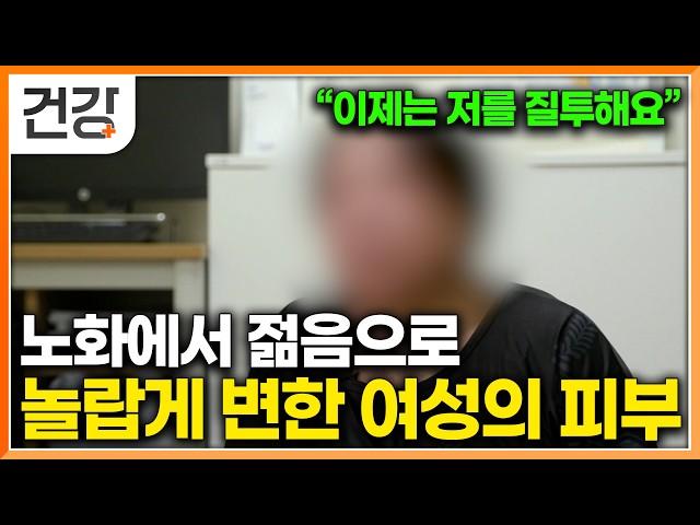 "이제는 제 피부를 질투해요" 자외선 노출로 인한 피부 광노화 되돌릴수 있다면!? │자외선 차단제 선택법│피부 노화 예방법│명의│#EBS건강