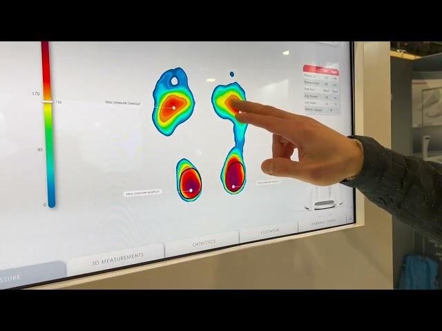 Aetrex 3d foot scanner video