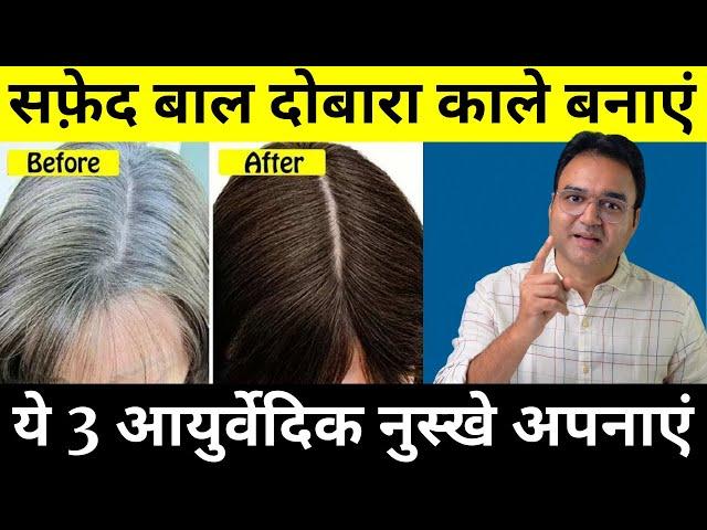 यह तीन चीज़ें 30 दिन लगाओ सारे सफेद बाल काले हो जाएंगे | White Hair To Black Hair Naturally