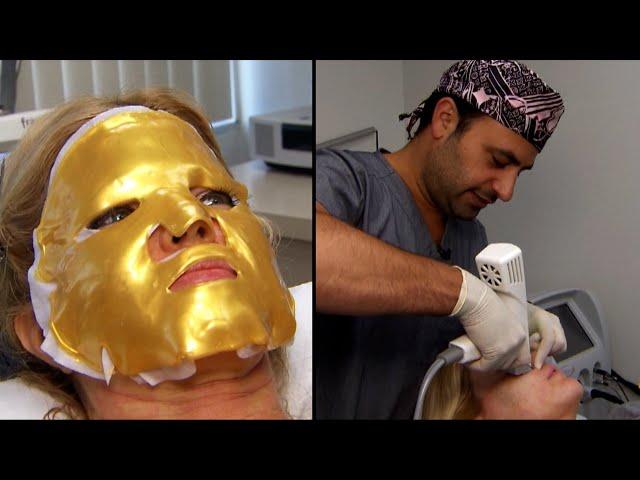 More Unusual Cosmetic Procedures