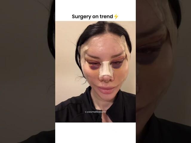 full face surgery#shorts #cosmeticsurgery #beauty