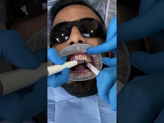 GBT Airflow Dental Hygiene Treatment Stain Removal