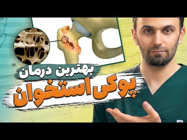 درمان پوکی استخوان و پیشگیری از آن | Osteoporosis prevention and treatment