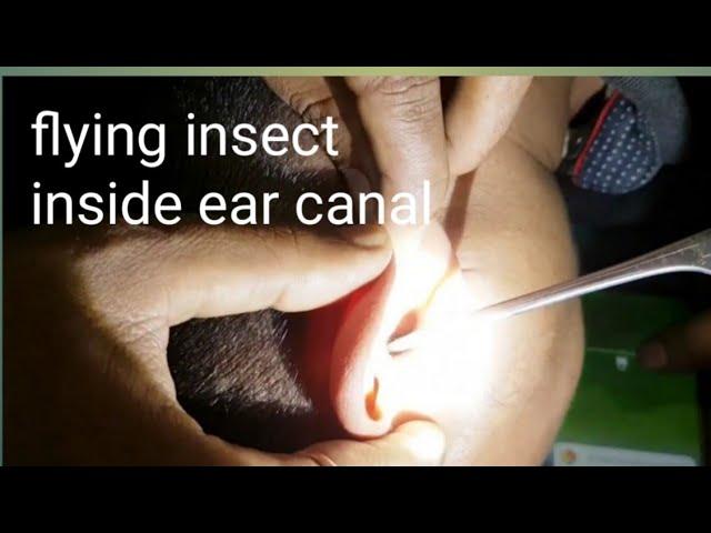 !!Something disturbing inside his ear canal !! || 昆虫  Konchū ||