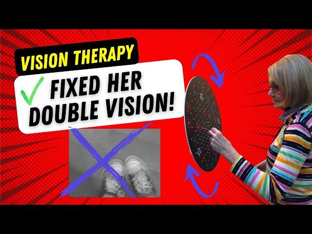 Blurred Vision and Double Vision fixed with Vision Therapy - Levin Eye Care Center