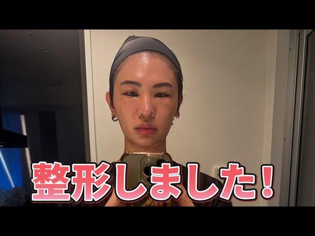 【美容整形】美容外科医が整形してみた！ダウンタイム公開！