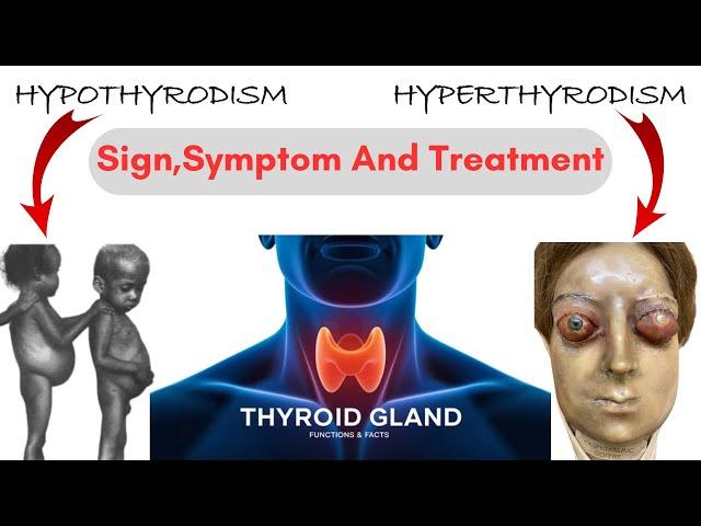 Hypothyroidism vs hyperthyroidism nclex | Hypothyroidism and hypothyroidism difference