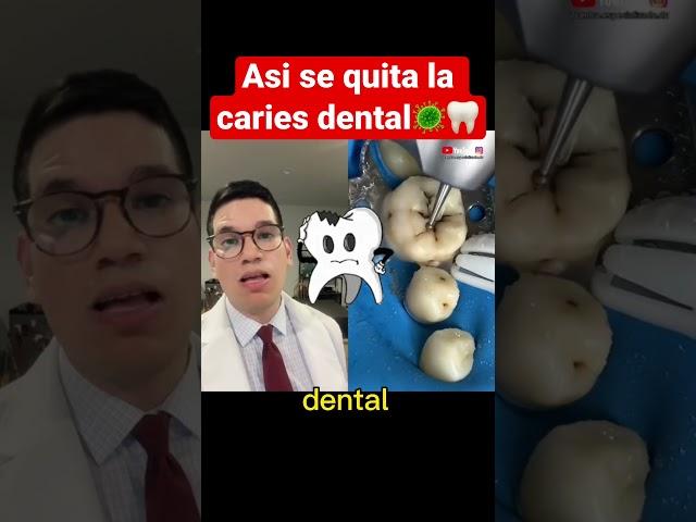 ASÍ SE QUITA LA CARIES DENTAL #shorts