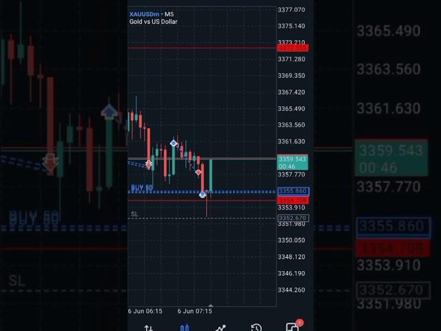 Trade 4 of $20-$2M. Join my free telegram signal channel, link in my description box #trading#frx#