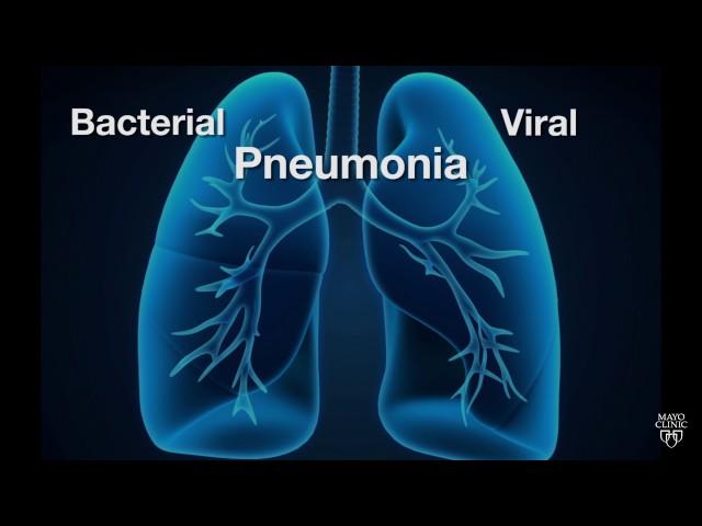 Mayo Clinic Minute: Is pneumonia bacterial or viral?