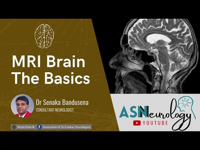 MRI Brain - The Basics by Dr Senaka Bandusena