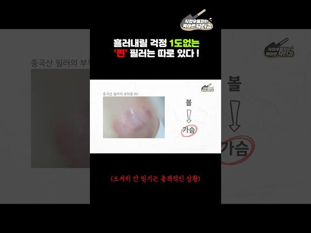 '찐'필러는 흘러내리지않는다고?! 흘러내리는 바디필러의 진실 2탄!