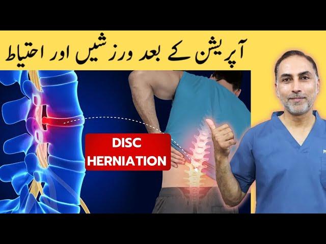 Exercises After Disc Surgery | Exercises And Precautions