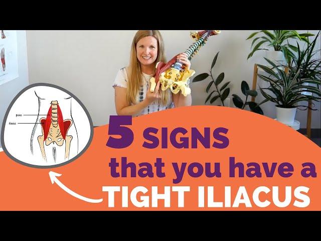 Top 5 Signs you have a tight iliacus