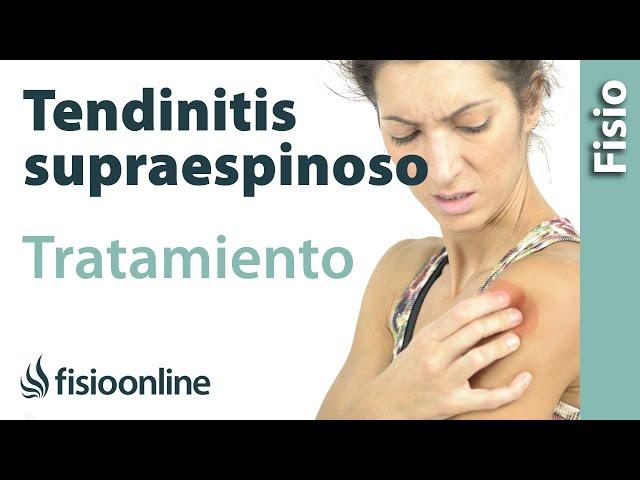 Tendinitis del supraespinoso - Tratamiento con ejercicios, automasajes y estiramientos