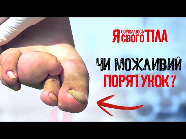 Коли руки не допомагають, а заважають – Я соромлюсь свого тіла | ЗДОРОВ’Я  | МЕДИЦИНА | ЛІКУВАННЯ