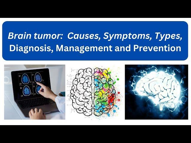 Brain Tumor  - Causes and Risk Factors, Symptoms, Diagnosis Management and Prevention