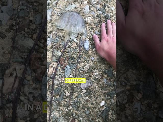 Painful Box Jellyfish Sting! | Coron Palawan