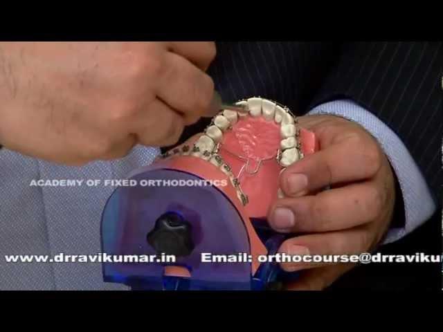 Orthodontic Mini Screw Implant (TAD) Course