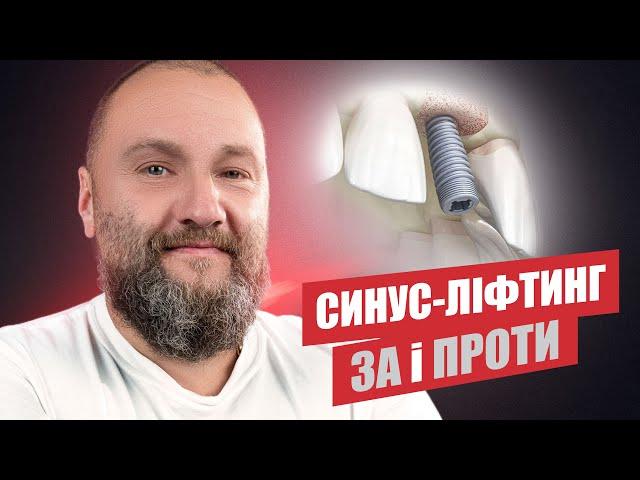  Синус-ліфтинг, чи варто робити?