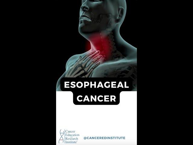 What is Esophageal Cancer? | Cancer Education and Research Institute (CERI) #canceredinstitute