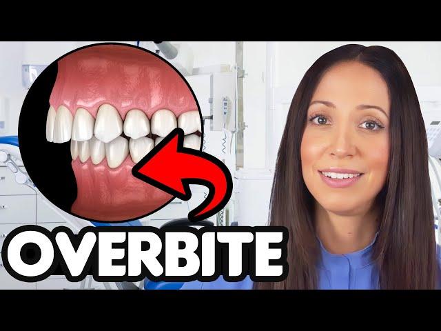 What's An Overbite?