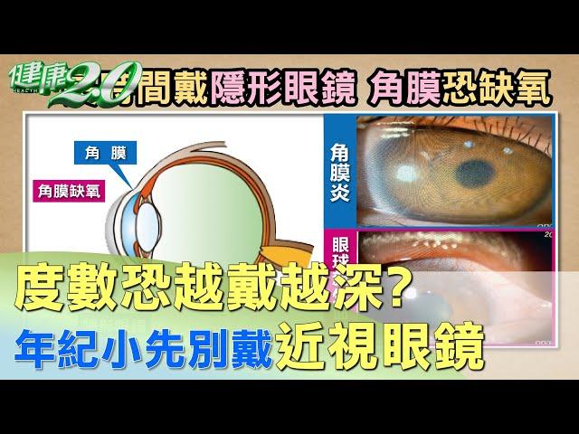 度數恐越戴越深？ 兒童年紀小先別戴近視眼鏡？ 健康2.0