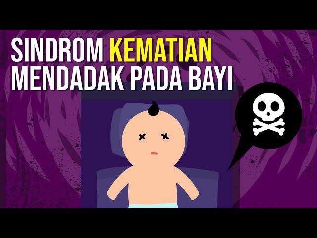 Sindrom Kematian Mendadak Pada Bayi