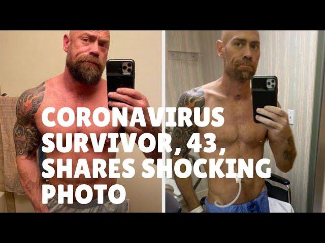 Mike Schultz -   Coronavirus survivor, 43, shares shocking photo showing 50-lb weight loss