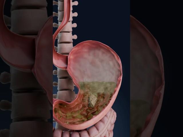 Bloating 3D visualization: what’s happening in your body?