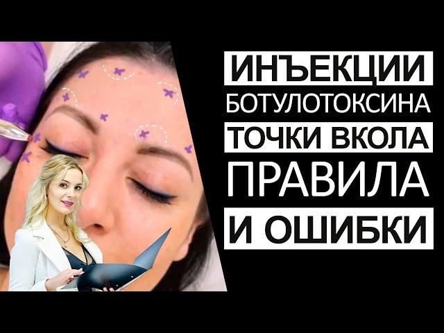 Инъекции ботулотоксина! Точки вкола, правила и ошибки