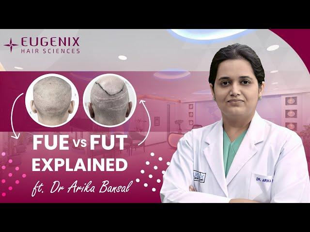 FUE Hair Transplant | FUT vs FUE Hair Transplantation Explained at Eugenix