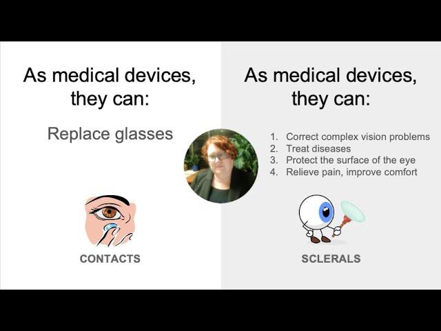 Sclerals vs Contacts