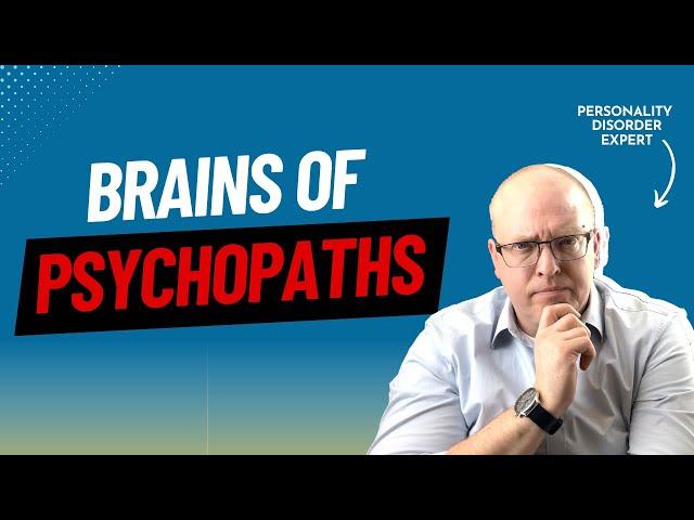Psychologist Explains 4 Ways Brains of Psychopaths Are Different