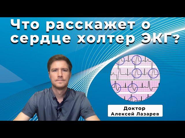 ЧТО РАССКАЖЕТ О СЕРДЦЕ ХОЛТЕР ЭКГ? #холтерЭКГ #ЭКГ #ДокторАлексейЛазарев